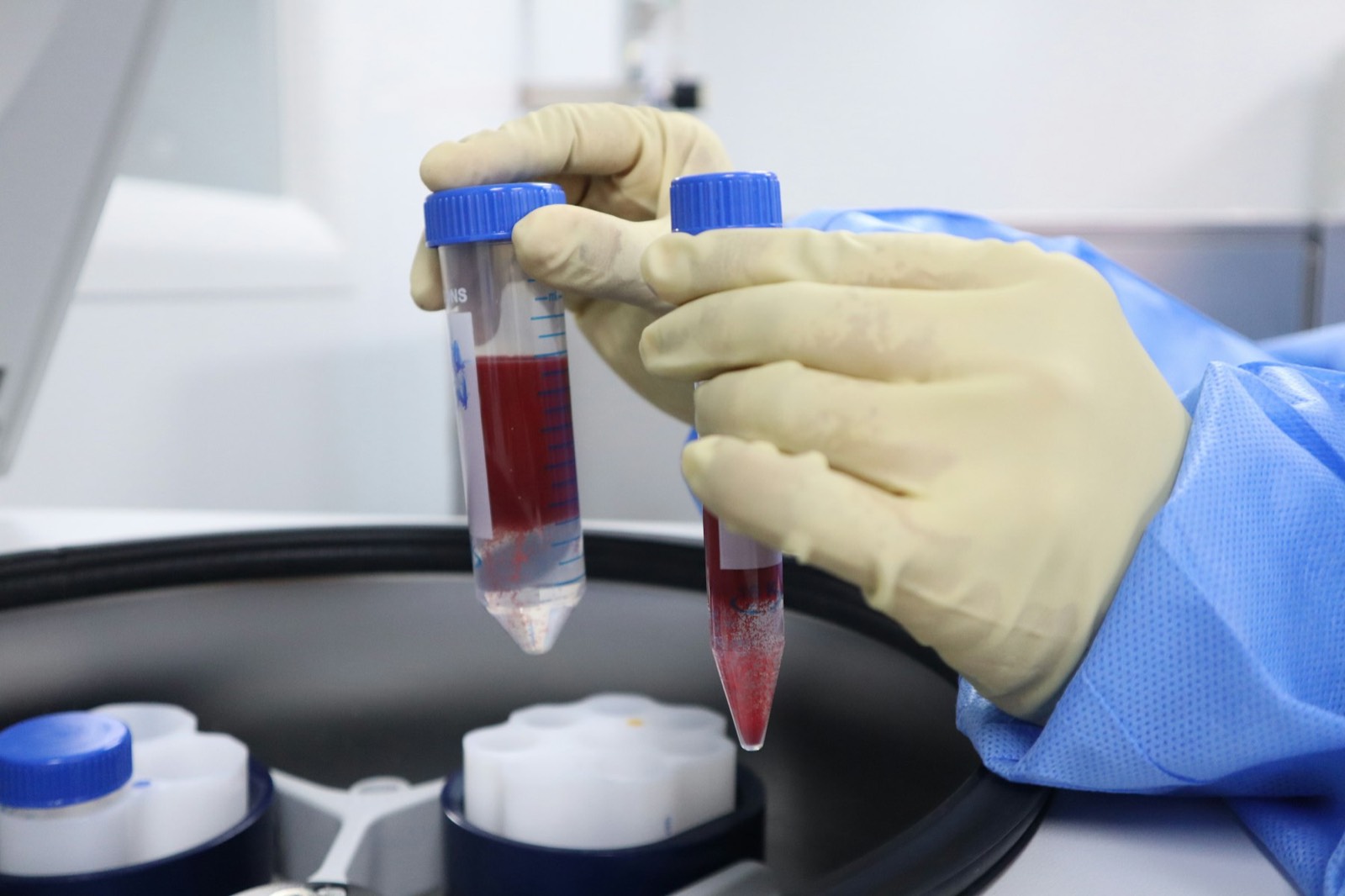 A lab technician holding a blood sample tube up to the light